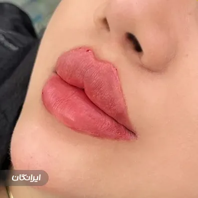 کلینیک زیبایی بهار