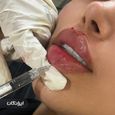 کلینیک زیبایی بهار