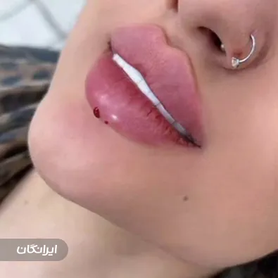 کلینیک زیبایی بهار