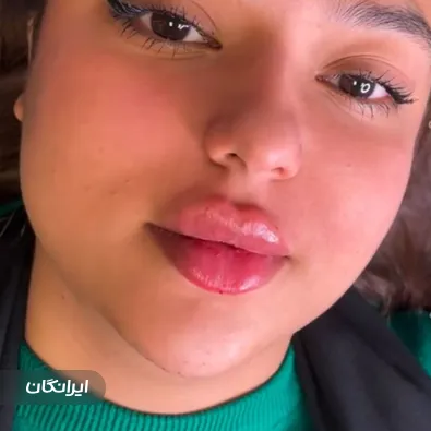 کلینیک زیبایی دکتر فاطمه خجسته پور