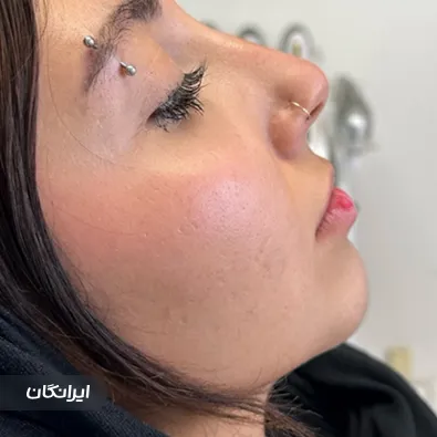 کلینیک زیبایی ربان