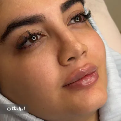 کلینیک زیبایی دکتر پگاه بنکدارپور