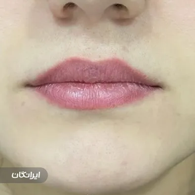 کلینیک زیبایی گلدن فیس