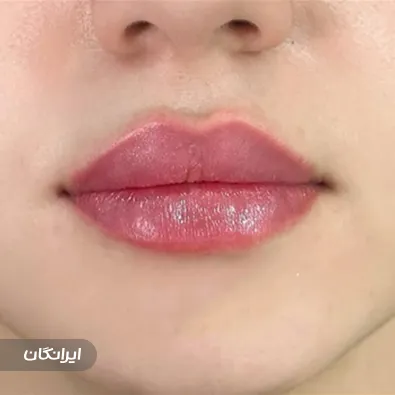 کلینیک زیبایی گلدن فیس