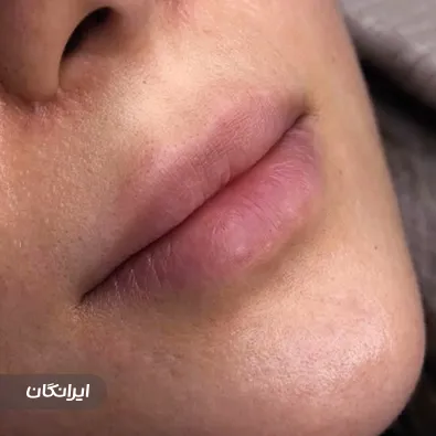 کلینیک زیبایی گلدن فیس