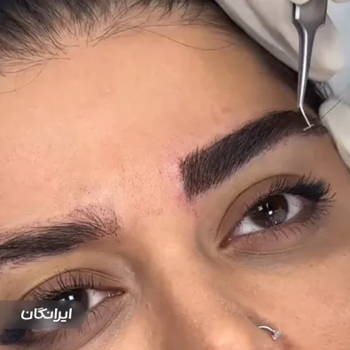 کلینیک زیبایی آیسان