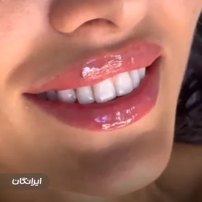 کلینیک زیبایی آوادیس