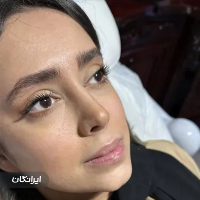 کلینیک زیبایی الین