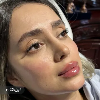 کلینیک زیبایی الین