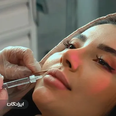 کلینیک زیبایی هورسام