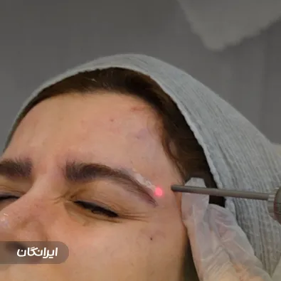 کلینیک زیبایی هورسام