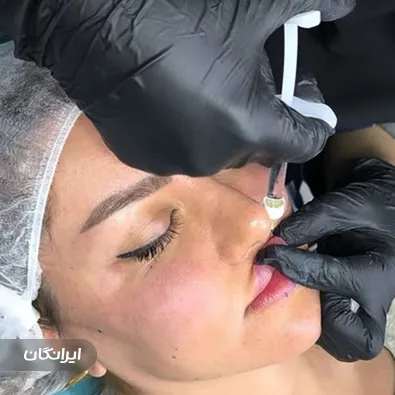 کلینیک زیبایی ابرا