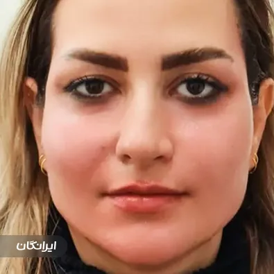 کلینیک زیبایی دکتر دنیز کتابچی