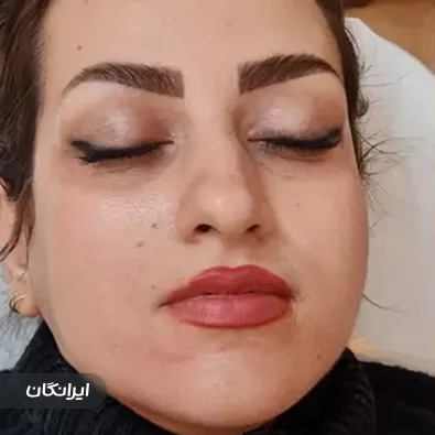 کلینیک زیبایی دکتر دنیز کتابچی