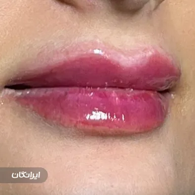 کلینیک زیبایی دکتر خشایار یزدانی