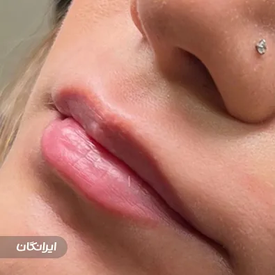 کلینیک زیبایی دکتر منیر بخت ور