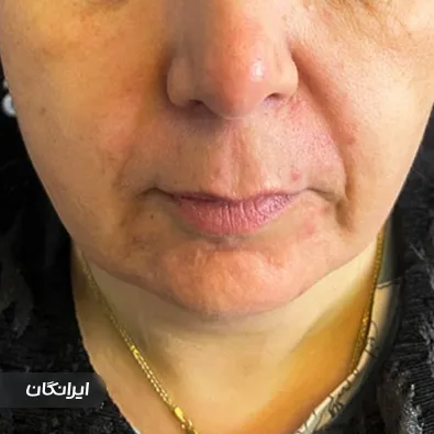 کلینیک زیبایی آنجل