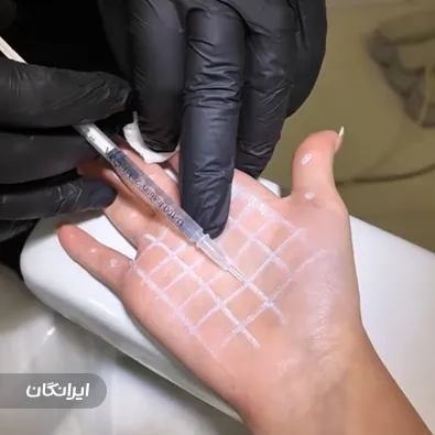 کلینیک زیبایی ژینو