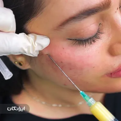 کلینیک زیبایی هوپولایف