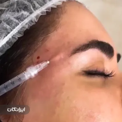 کلینیک زیبایی آوا بیوتی