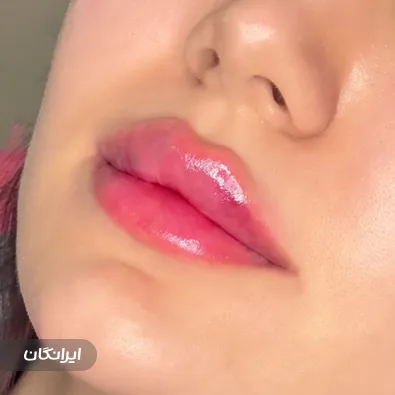 کلینیک زیبایی دکتر مهشید بارانی