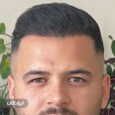 کلینیک کاشت مو احمدی