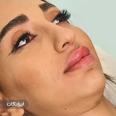 کلینیک زیبایی بنیز