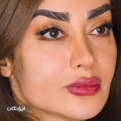 کلینیک زیبایی بهار