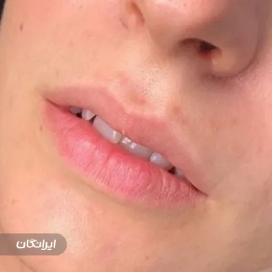 کلینیک زیبایی هستیا