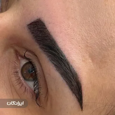 کلینیک زیبایی بهتا