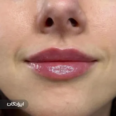 کلینیک زیبایی دکتر آرزو خرمالی