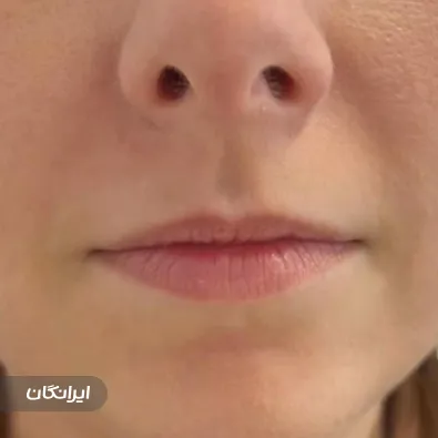 کلینیک زیبایی دکتر آرزو خرمالی