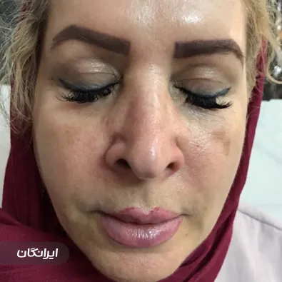 کلینیک زیبایی دکتر کاظم غضنفری