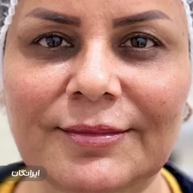 کلینیک زیبایی ایراندخت