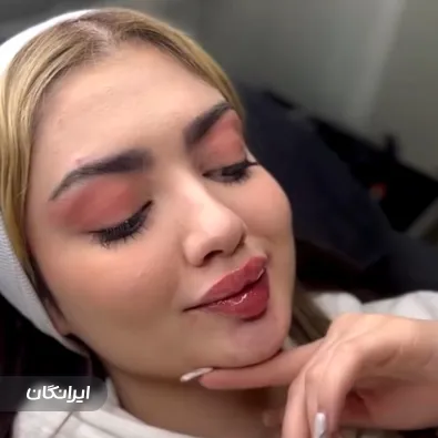 کلینیک زیبایی نیوفیس