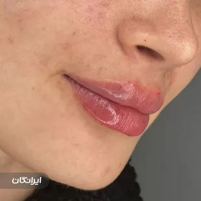 کلینیک زیبایی دکتر زکیه تفت