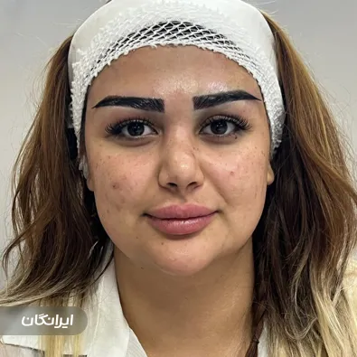 کلینیک کاشت ابرو و مژه دیناز