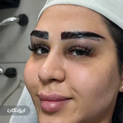 کلینیک کاشت ابرو و مژه دیناز