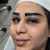 کلینیک کاشت ابرو و مژه دیناز