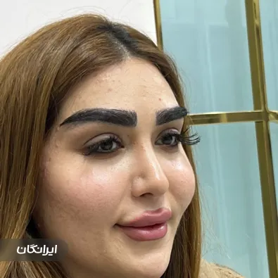 کلینیک کاشت ابرو و مژه دیناز