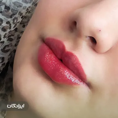 مطب درمان زخم و زیبایی هیداوی