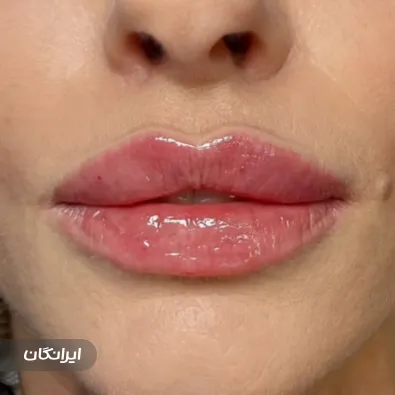 مطب درمان زخم و زیبایی هیداوی