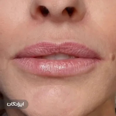 مطب درمان زخم و زیبایی هیداوی