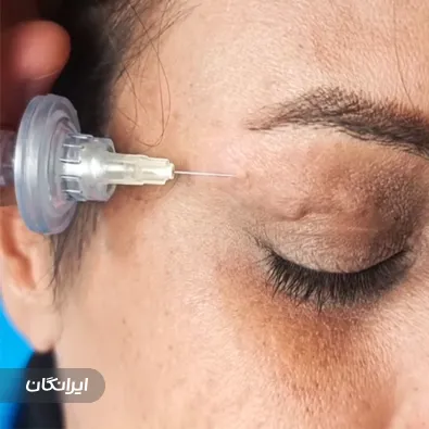 کلینیک زیبایی نهال