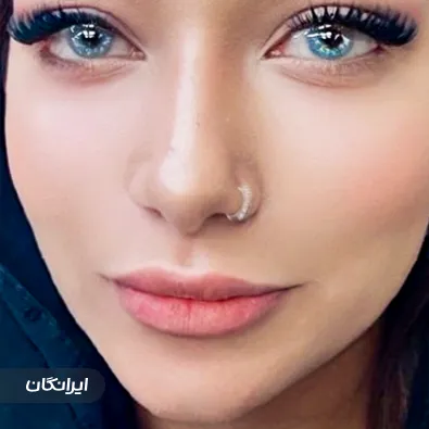 کلینیک زیبایی دکتر پرناز حیدری