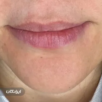 کلینیک زیبایی دکتر طلیعه خشای