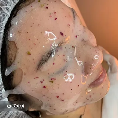 کلینیک زیبایی هکا