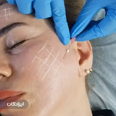 کلینیک زیبایی هکا