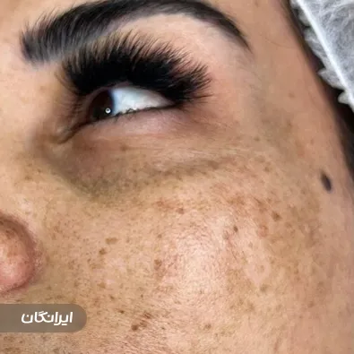 مرکز خدمات پوستی اسکین تایم