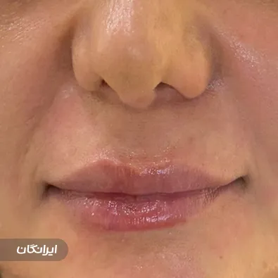 کلینیک زیبایی دکتر مریم خسرویان